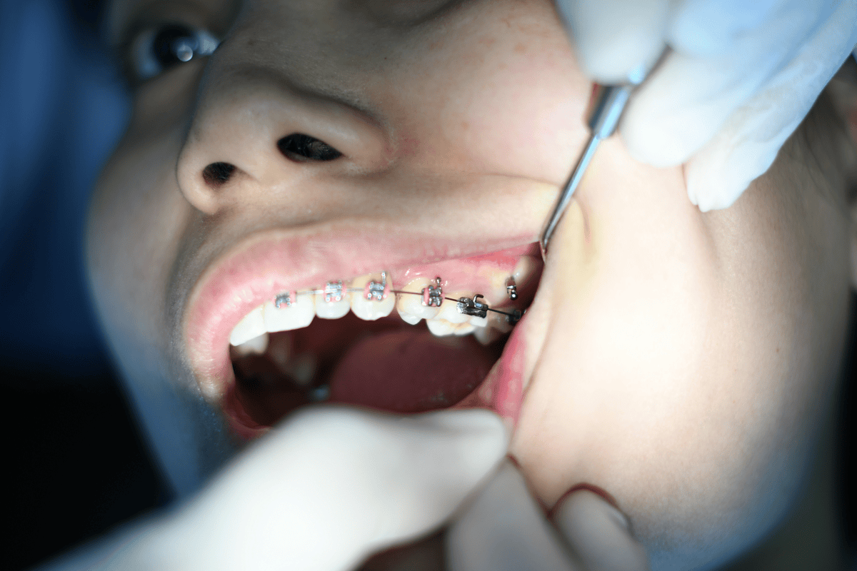 Nerovet AI Dentistry: Revolutionizing the Future of Oral Health